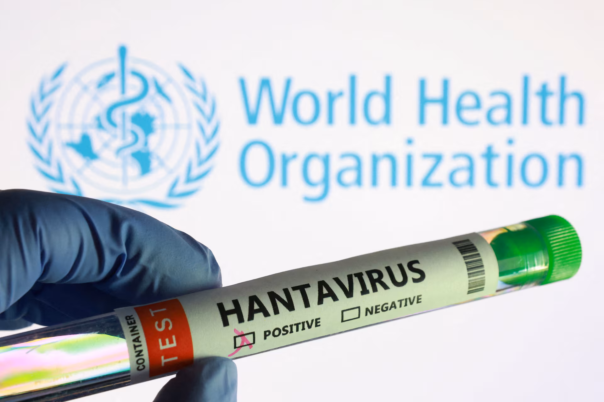 Hantavirus Outbreak Aboard MV Hondius